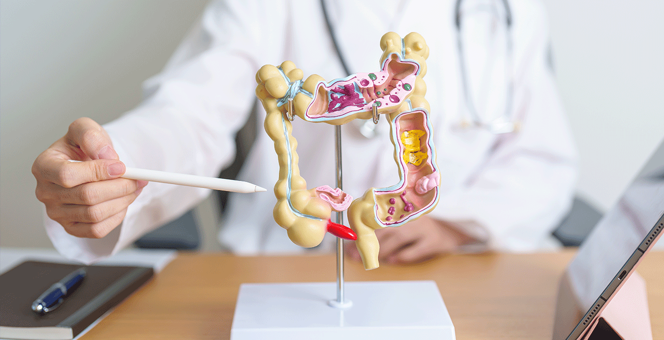 Doctor with a human colon anatomy model, illustrating colorectal anatomy for diagnosis and early detection of colorectal cancer.