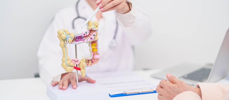 Colorectal doctor explaining colonoscopy results using a colon model