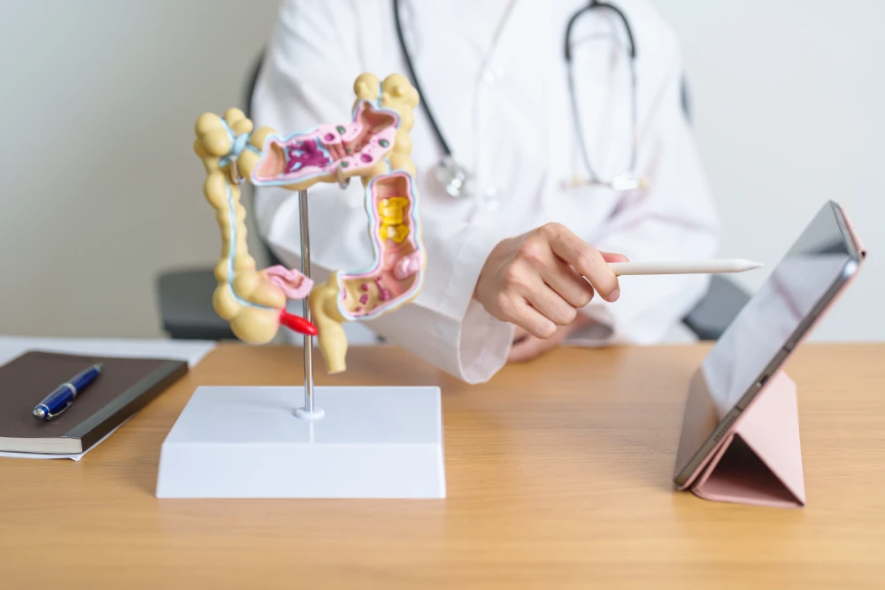 Doctor using a human anatomy model to explain colonoscopy findings.